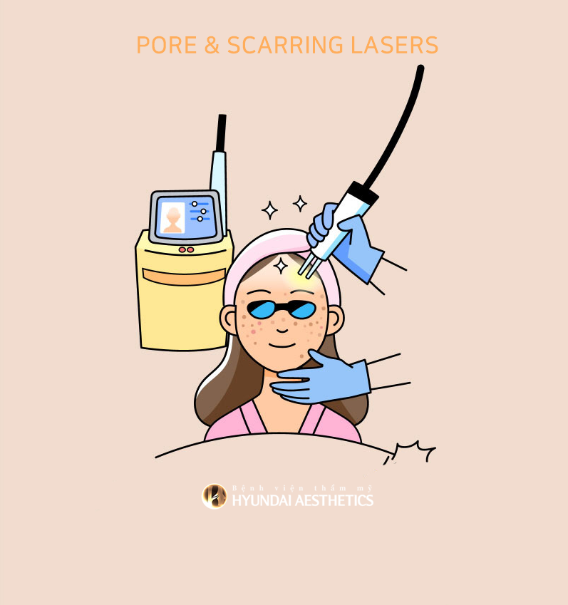 Lỗ chân lông và sẹo laser